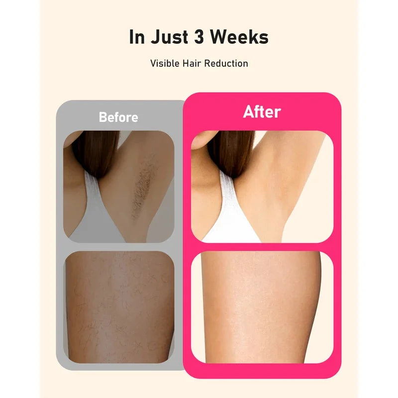 Laser Hair Removal 999999+ Fast flashes 3 In 1 IPL At Home Hair Remover Machine for Women Men Permanent Epilator on Face Body